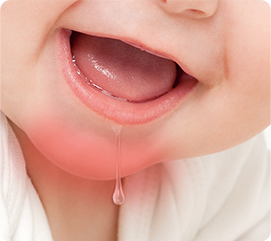 Drool Rash